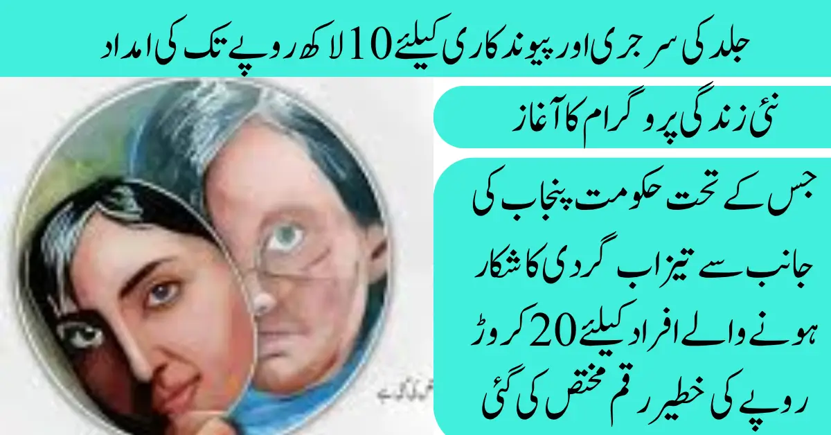 How Acid Attack Victims Can Apply for Nayee Zindagi Program 2025